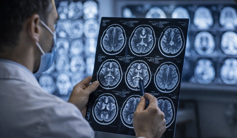 Doctor reviewing brain MRI scans, holding the film up and pointing to an area of the images in a medical imaging room.