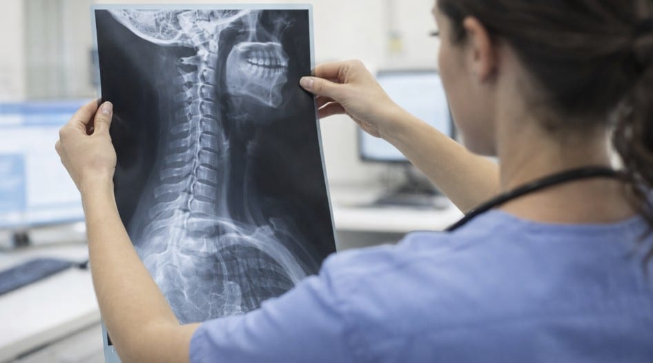 A healthcare professional examines a spinal X-ray, holding the radiograph up to the light in a clinical setting while focusing on the vertebrae.